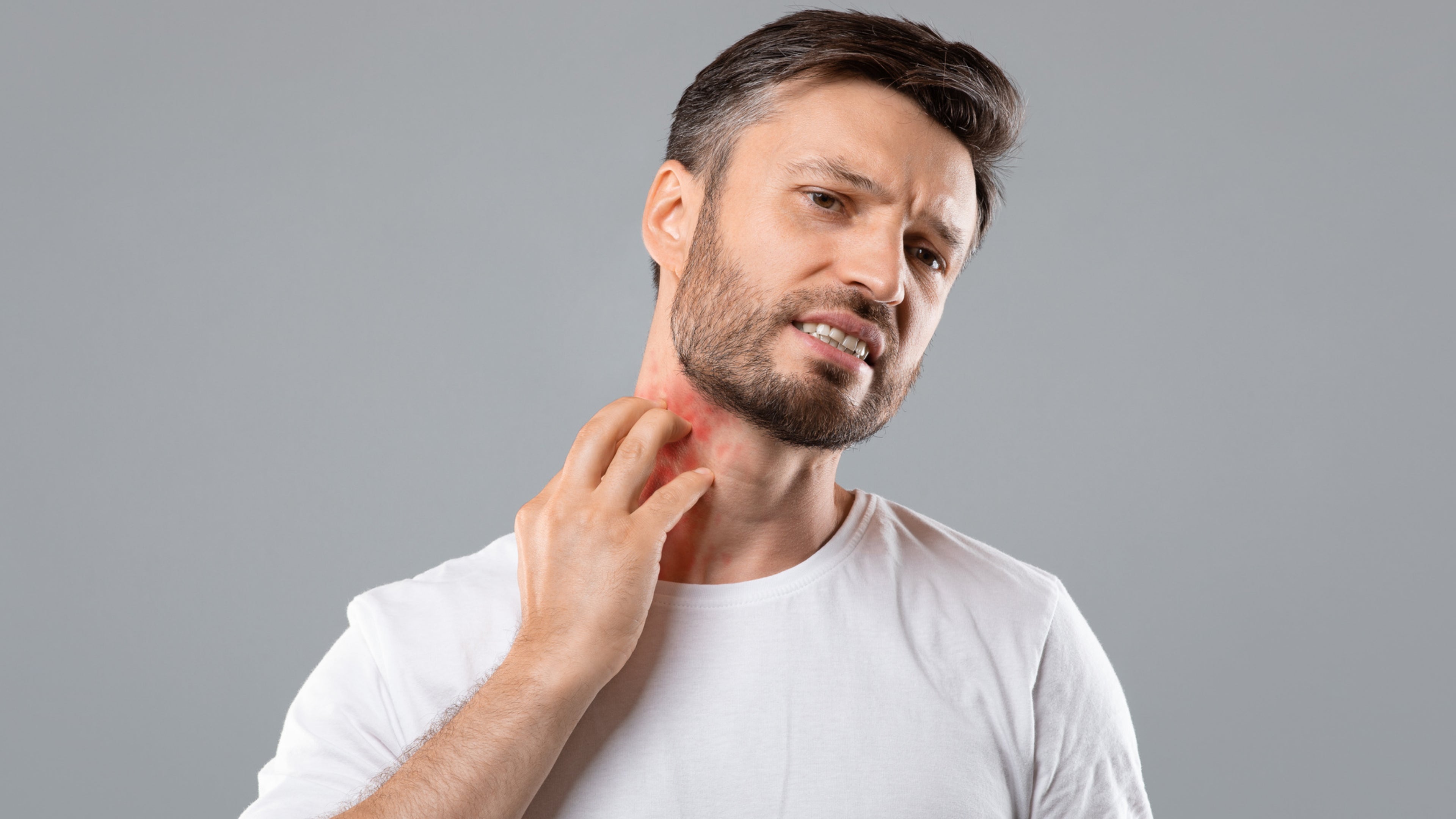 Relief for Sensitive Skin: Gentle Skincare Routine for Eczema-Prone Individuals
