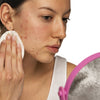 Jericho Skincare's Secrets to Fading Acne Scars: Tips and Product Recommendations