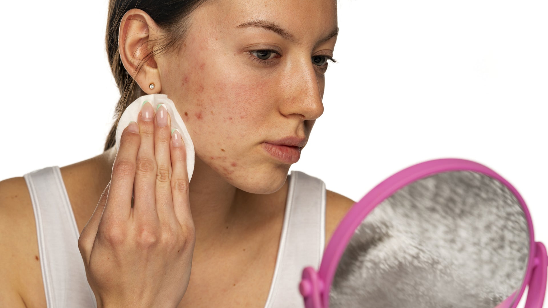 Jericho Skincare's Secrets to Fading Acne Scars: Tips and Product Recommendations
