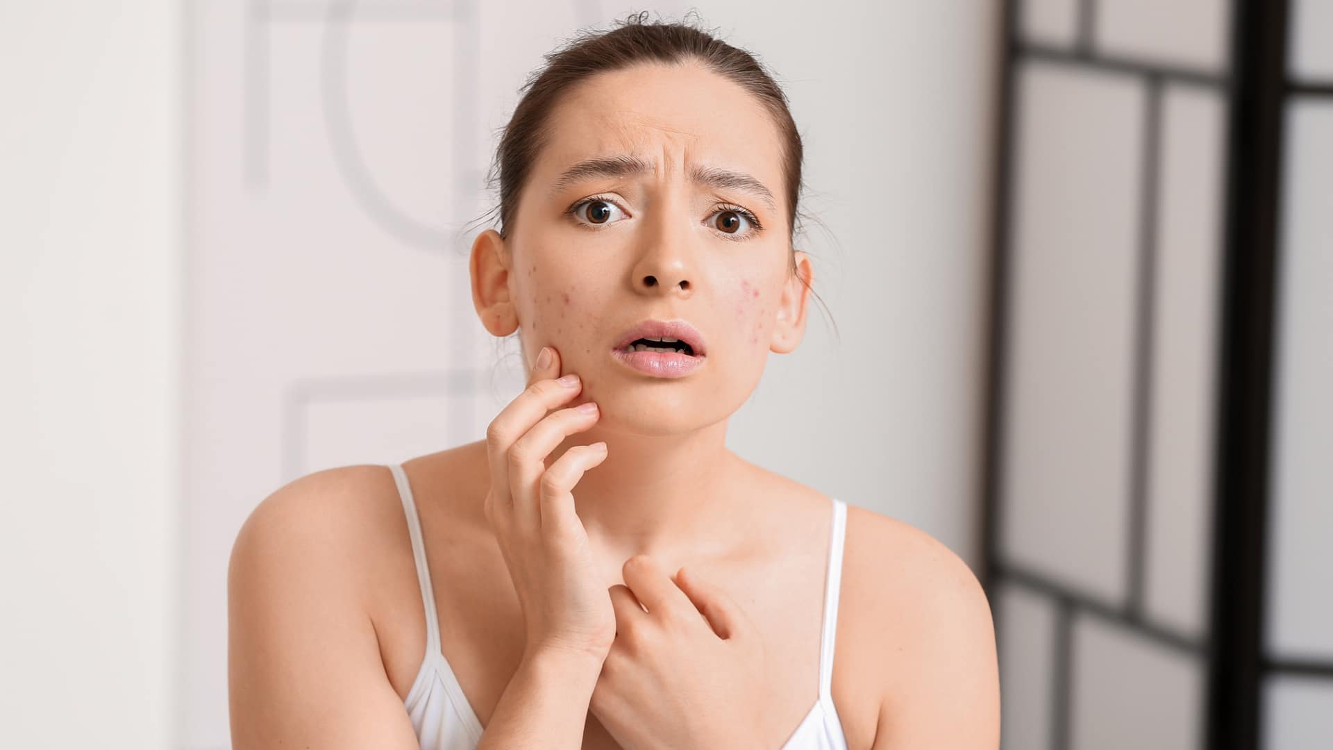 What Are the Signs of Skin Congestion? And How to Treat It
