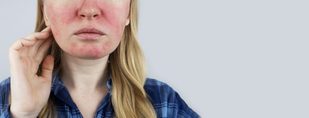 Sensitive vs. Sensitised Skin: Understanding and Caring for Reactive Skin